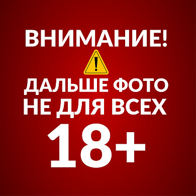 В Ивановской области собака едва не загрызла женщину 